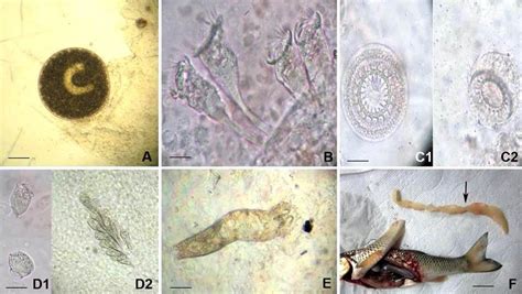  Ichthyophthirius Multifiliis: Une Menace Microscopique Qui Fait Trembler les Poissons!